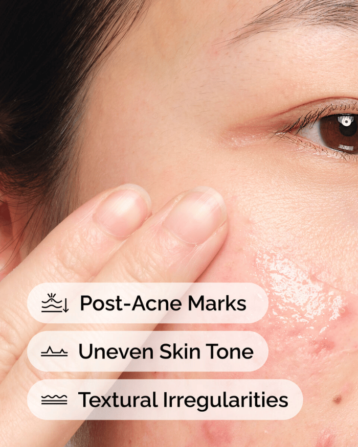 Niacinamide 10% + Zinc 1%